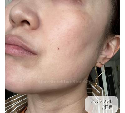 アスタリフト・コラーゲンドリンクを飲んだ感想