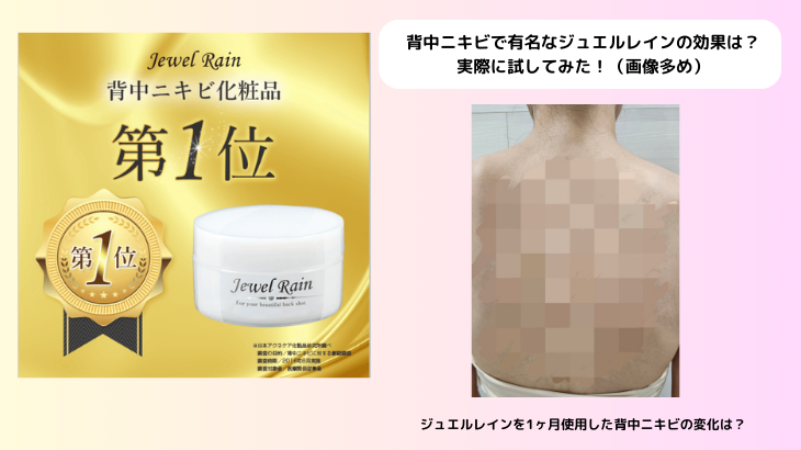 背中ニキビで有名なジュエルレインの効果は？ 実際に試してみた！（画像多め）